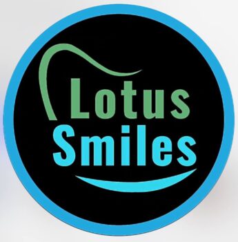 Lotus Smiles
